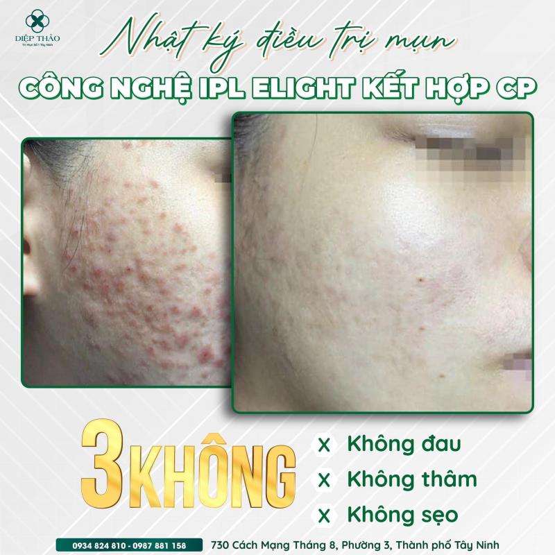 Diệp Thảo Medi-Spa