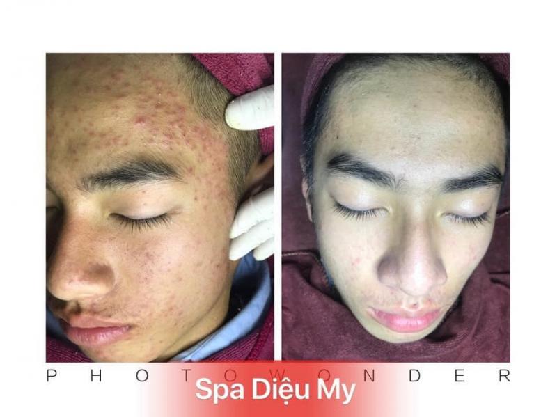 Diệu My Spa