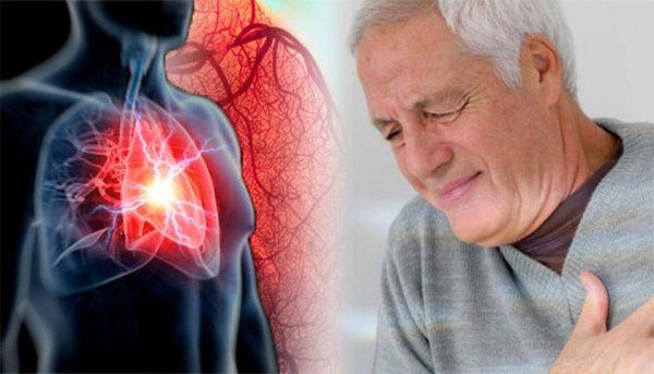 Điều trị nhồi máu cơ tim như thế nào?