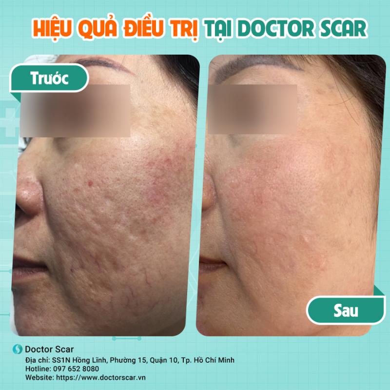 Doctor Scar