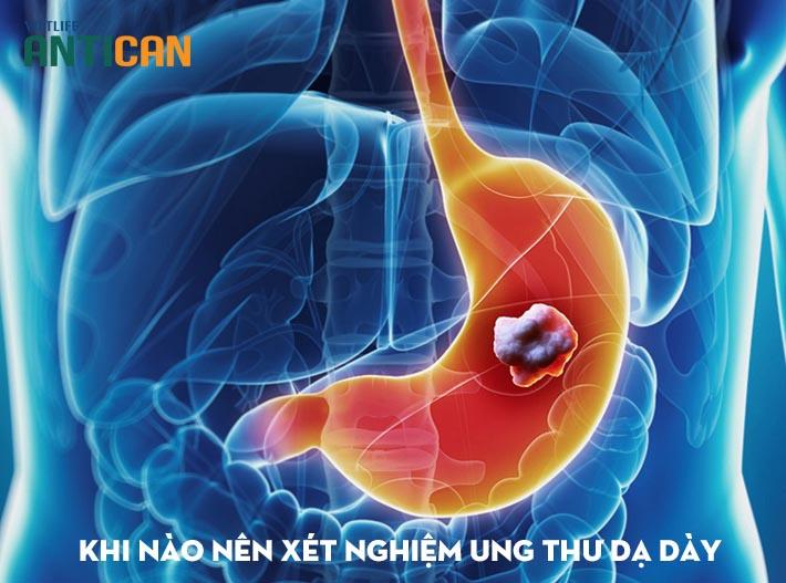 Đối tượng cần làm xét nghiệm ung thư dạ dày