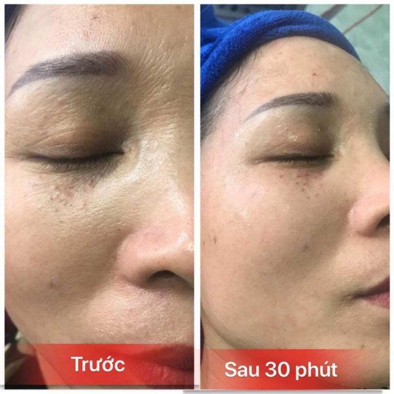Thẩm Mỹ Uyên Lee