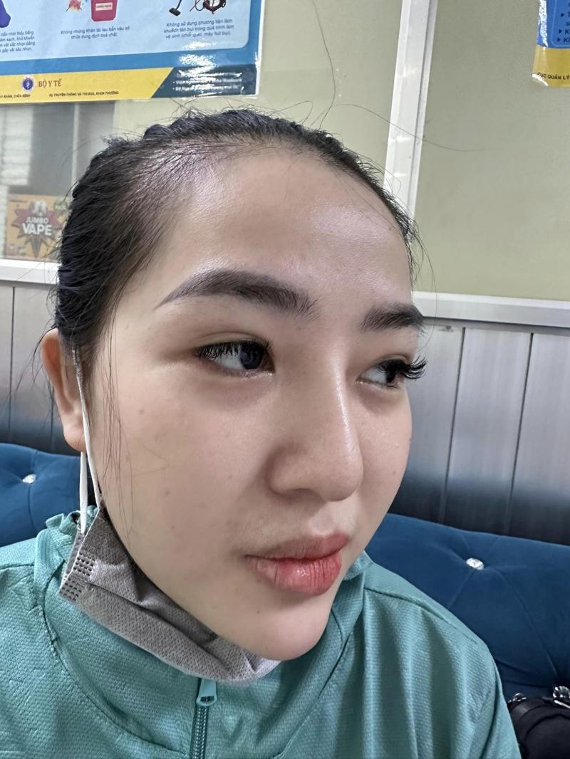Dr. Lee phẫu thuật thẩm mỹ