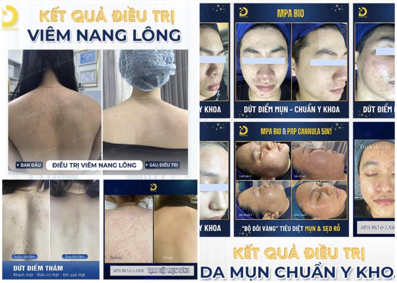 Dr.Choice Clinic – Chuyên trị mụn chuẩn y khoa uy tín