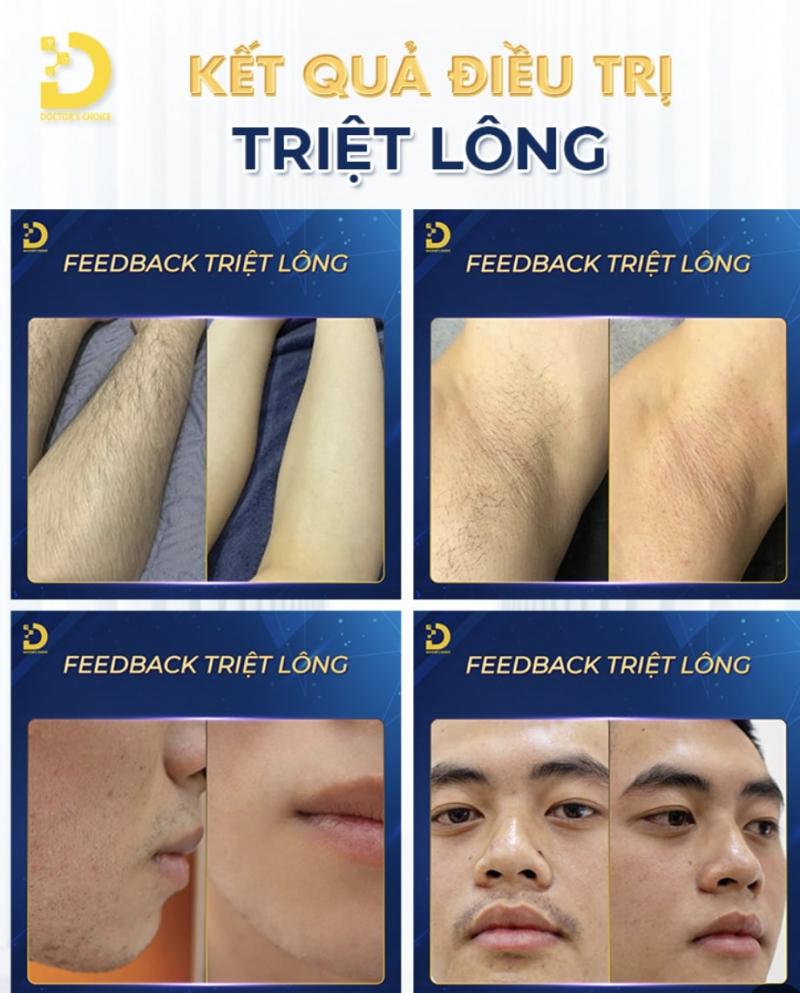 Dr.Choice Clinic – Chuyên triệt lông tận gốc & chăm sóc da uy tín ở TpHCM