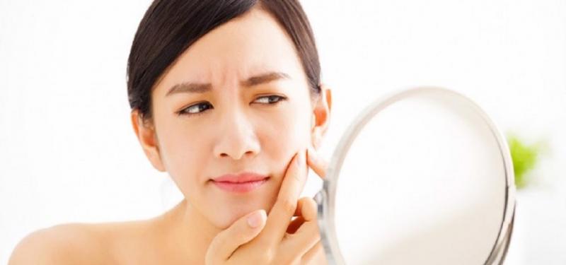 Đường gây ra mụn