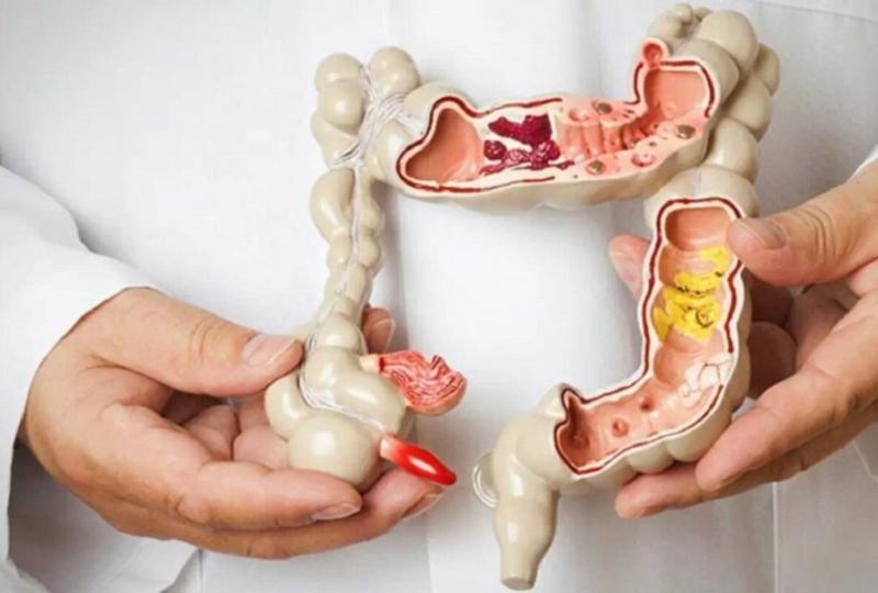 Đường ruột là cơ quan duy nhất có hệ thần kinh độc lập