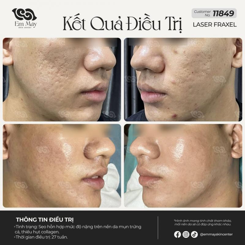 Em Mây Skin Center