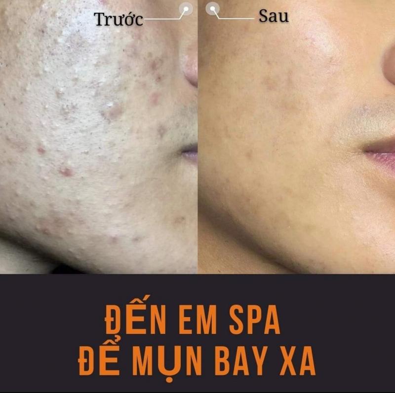 EM Spa