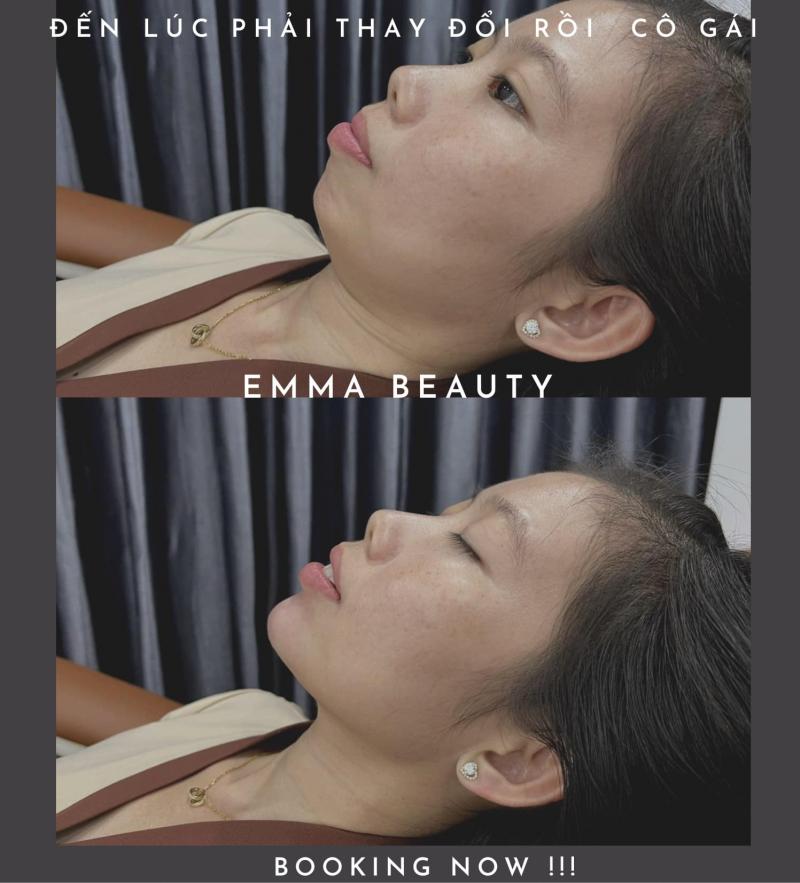 Emma Beauty