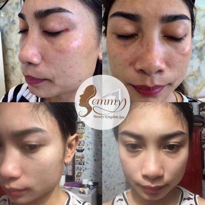 Thẩm Mỹ Quốc Tế Emmy - Hà Tĩnh
