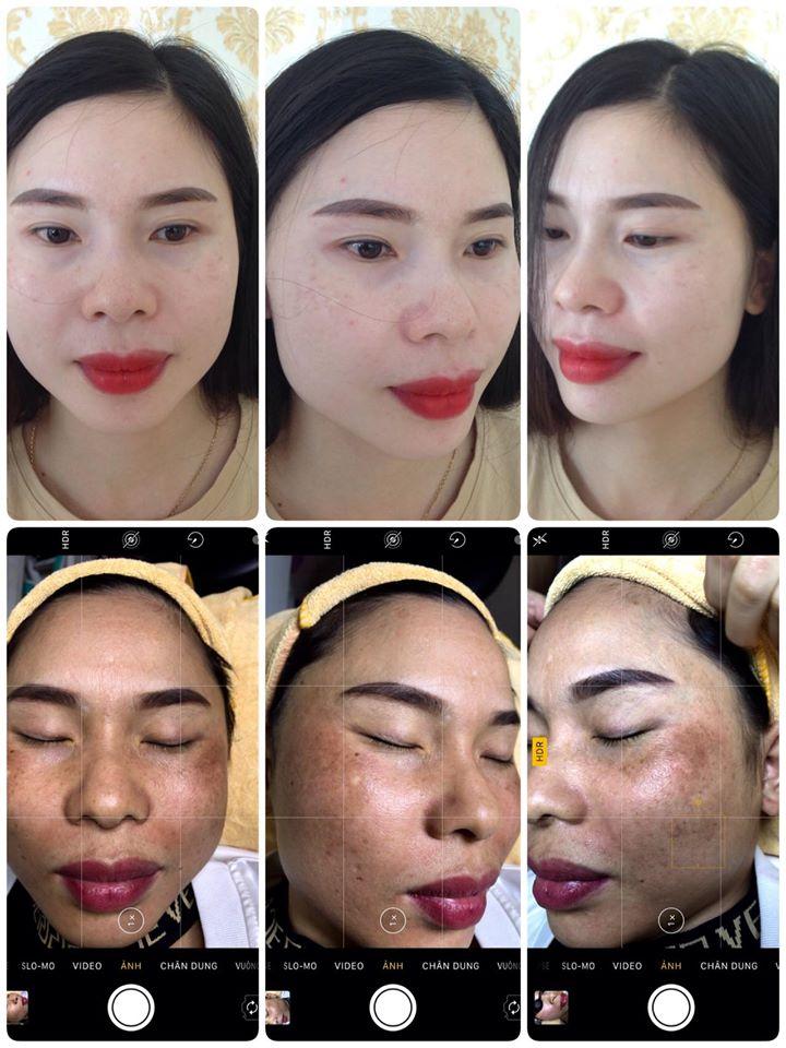 Thẩm Mỹ Quốc Tế Emmy - Hà Tĩnh