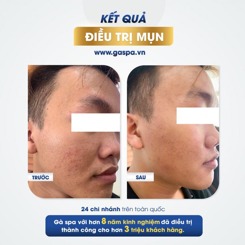 Nhiều vấn đề về da được Gà Spa cải thiện rõ nét