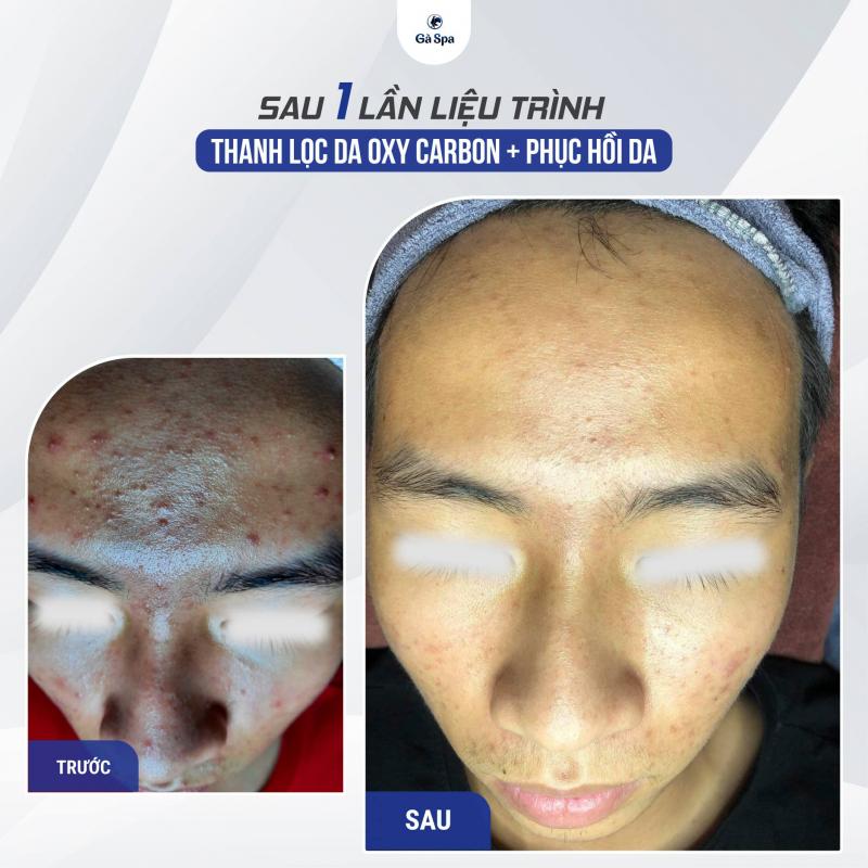 Gà Spa