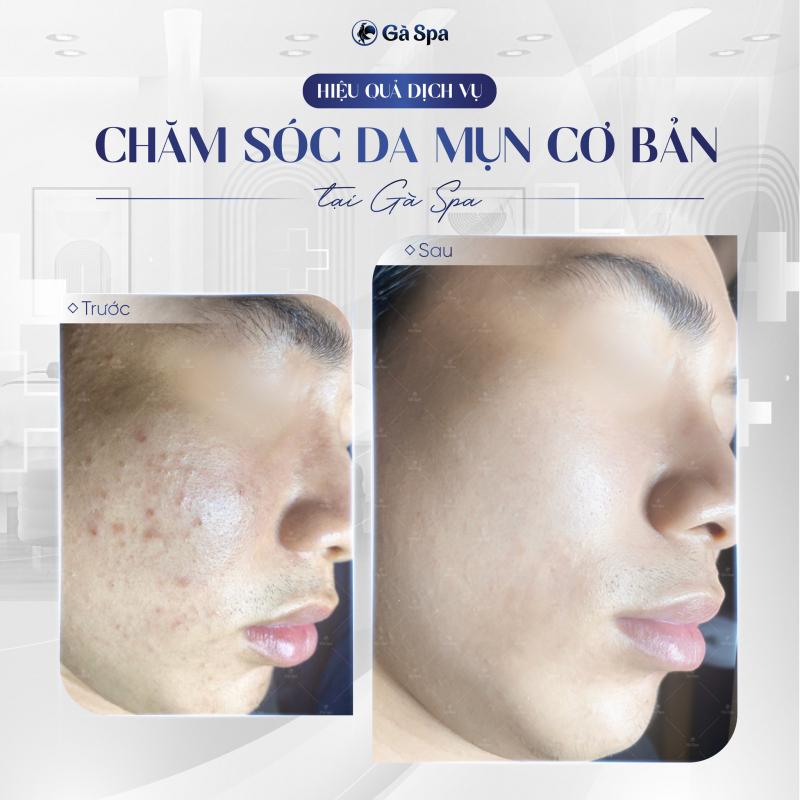 Gà Spa Biên Hòa