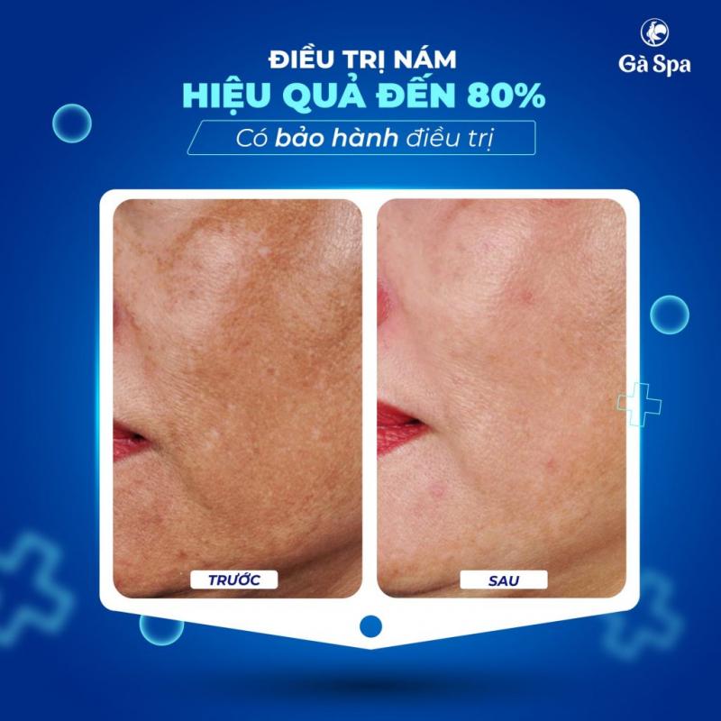 Gà Spa Biên Hòa