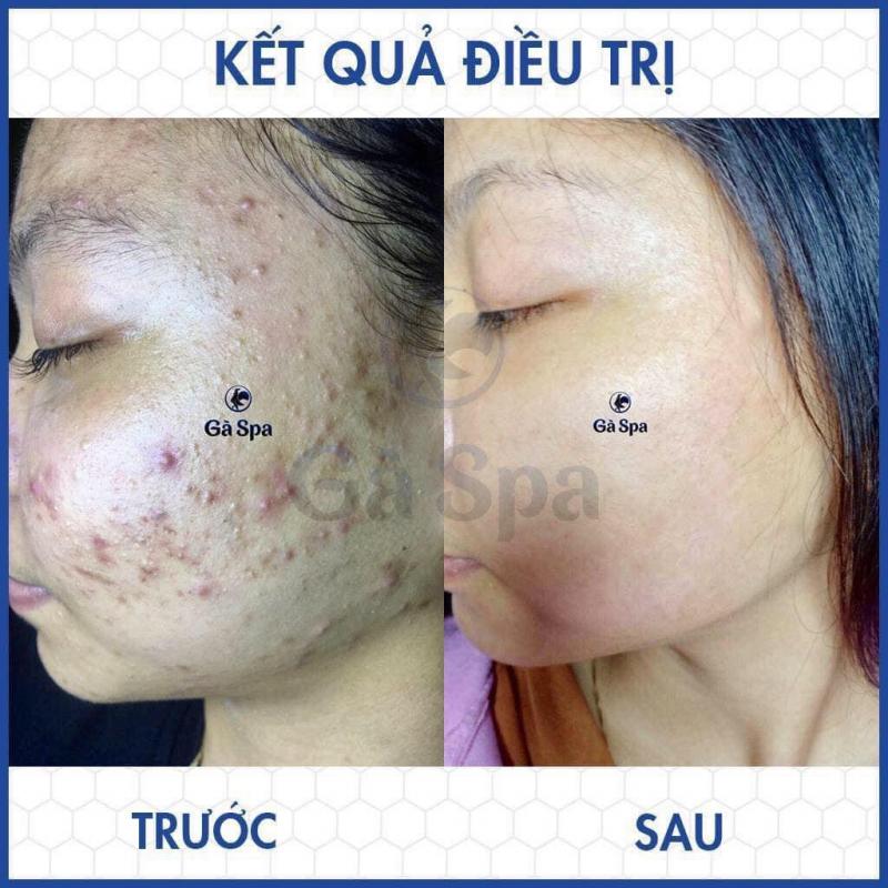 Gà Spa Thuận An - Bình Dương