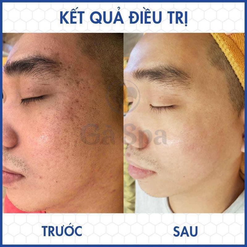 Gà Spa Thuận An - Bình Dương