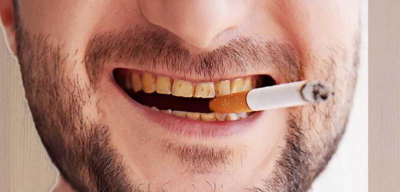 Hút thuốc lá gây ố vàng răng và rụng răng