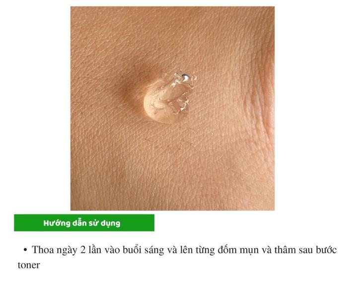 Gel giảm mụn ẩn và thâm Gamma Megaduo