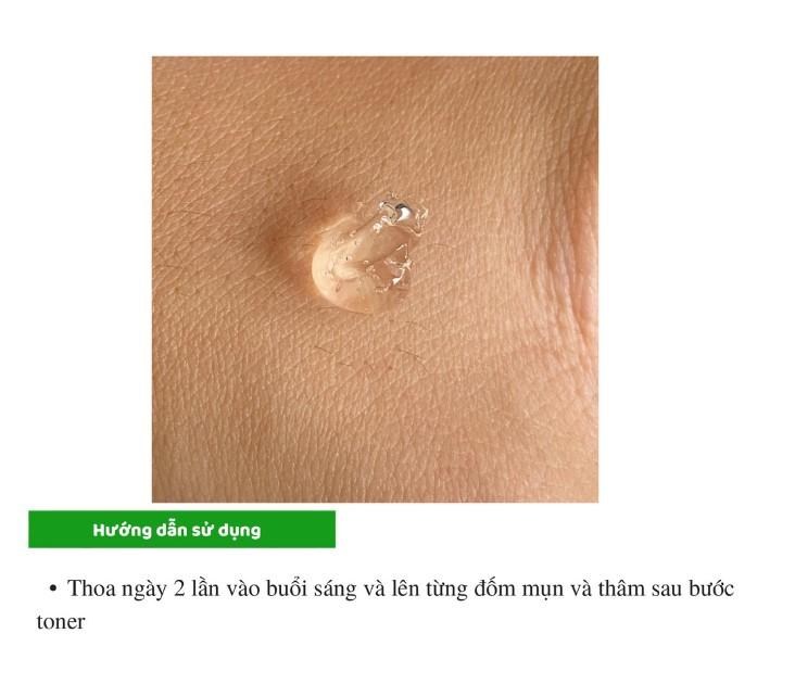 Gel trị mụn Megaduo