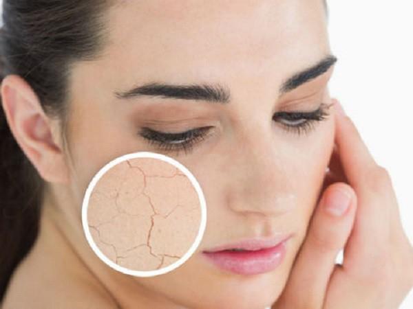 Bức xạ điện thoại gây khô da