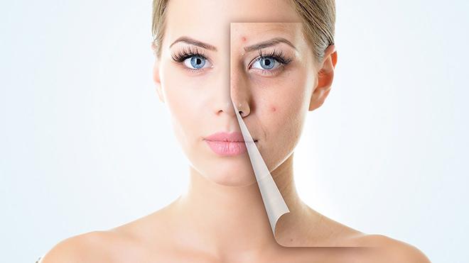Sử dụng di động quá nhiều trong thời gian dài nên xuất hiện những nốt mẩn đỏ trên má