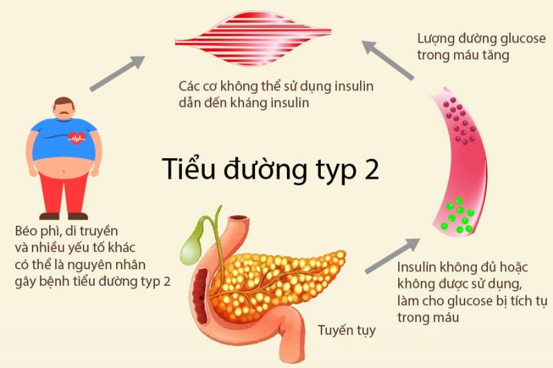 Ngủ không đủ giấc cũng có sự liên quan mạnh mẽ đến các tác dụng phụ với lượng đường trong máu