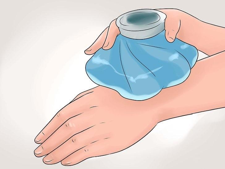 Giảm sưng bằng túi nước lạnh