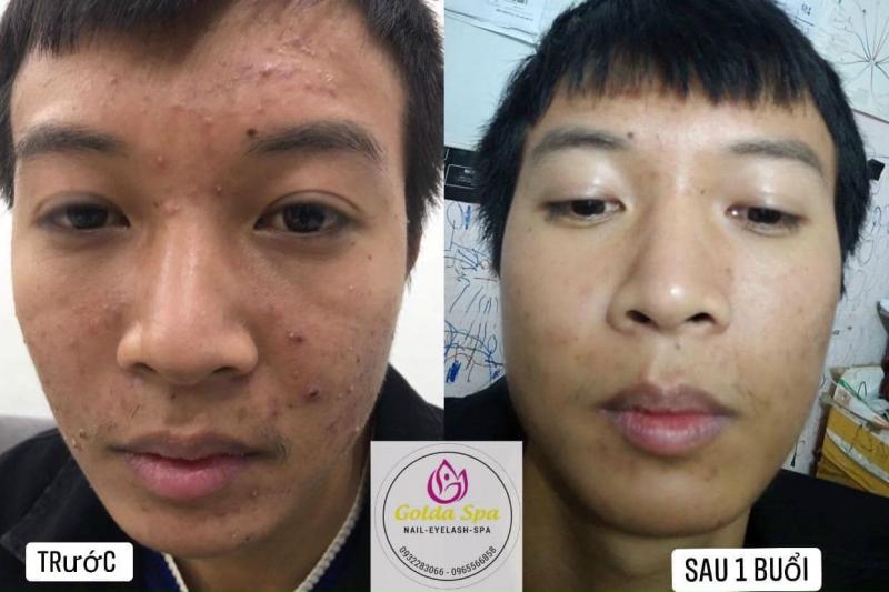 GOLDA SPA Thanh Hóa