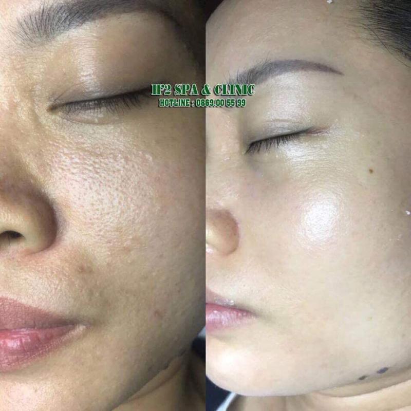 H'2 spa & Clinic