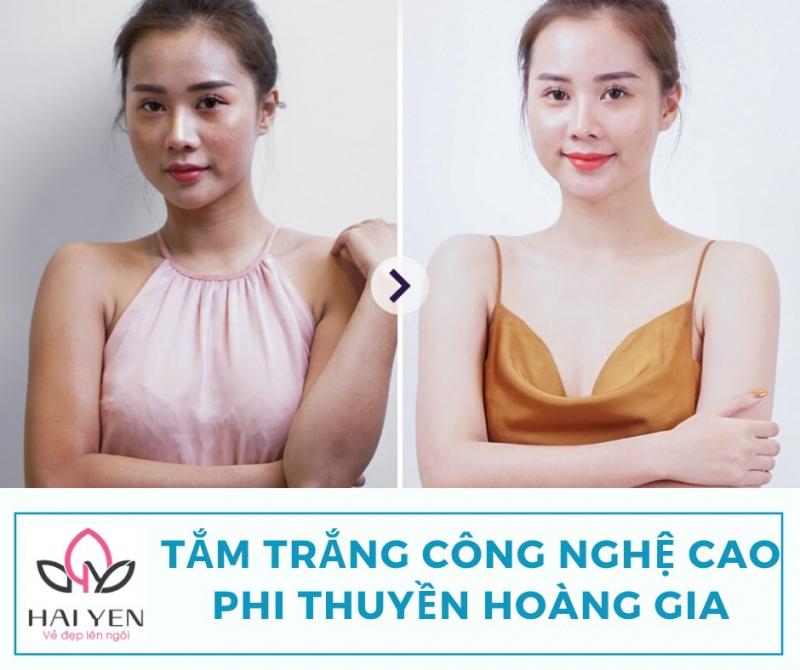 Hải Yến Spa