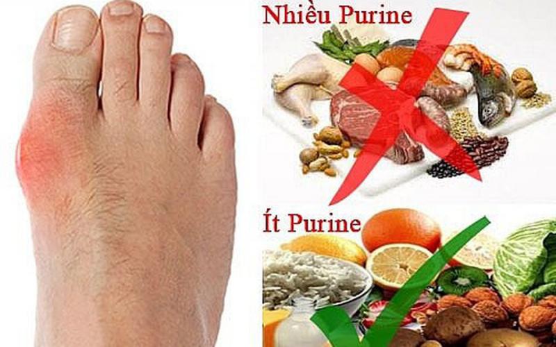 Cố gắng hạn chế tối da khẩu phần ăn chưa nhiều purine