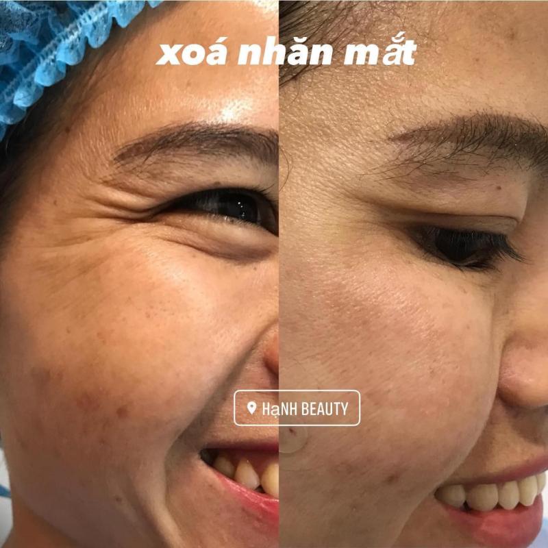 Hạnh Beauty