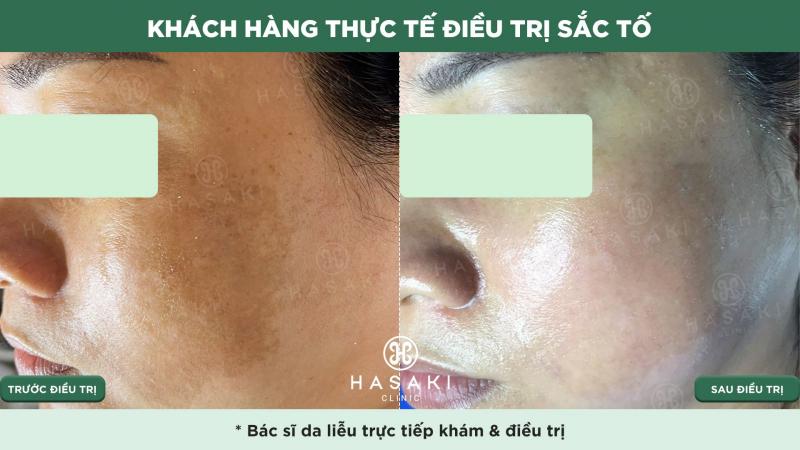 Hasaki Beauty & Clinic