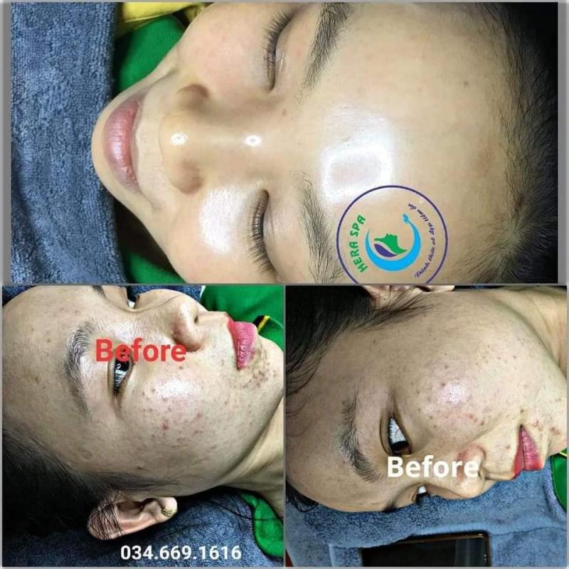 Hera Spa Clinic & Academy