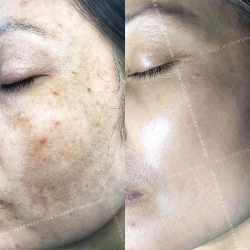 ﻿﻿Hiền Neen Spa