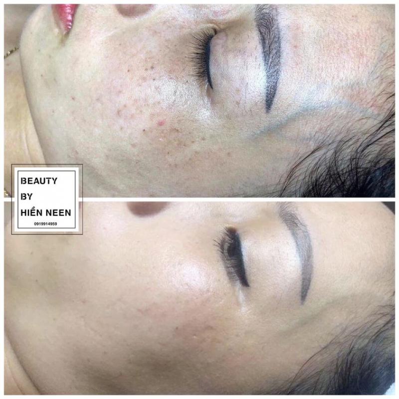 ﻿﻿Hiền Neen Spa