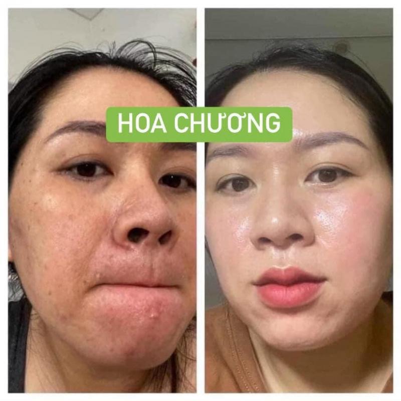 Hoa Chương Spa Biên Hòa