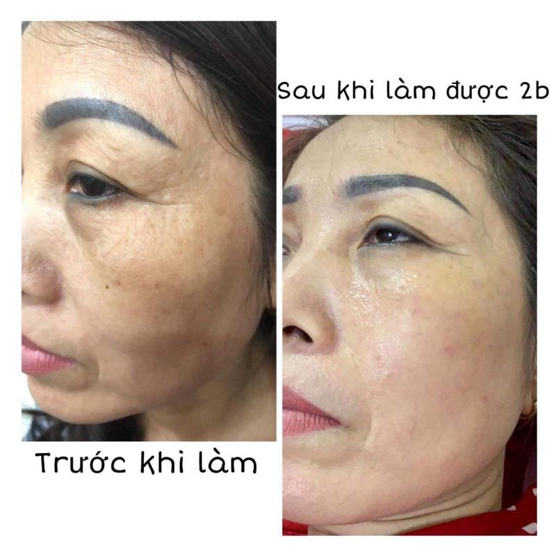 Hoa Lan Spa