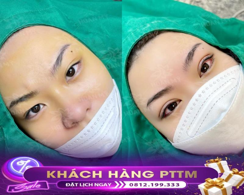 Hoàn Mỹ Beauty Center