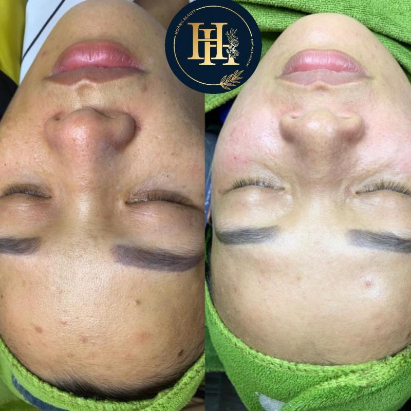 Hoàng Beauty & Spa