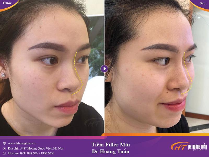 Thẩm mỹ viện Hoàng Tuấn