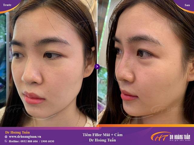 Thẩm mỹ viện Hoàng Tuấn