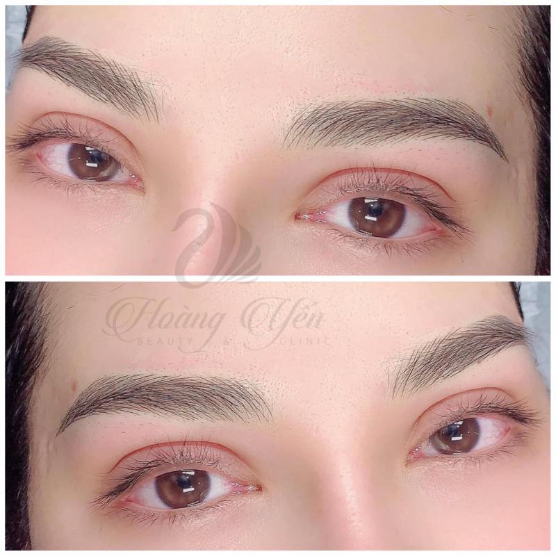 Hoàng Yến Beauty & Clinic
