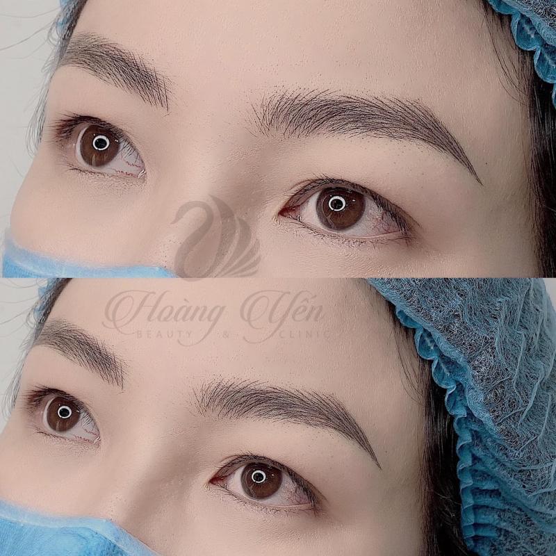Hoàng Yến Beauty & Clinic