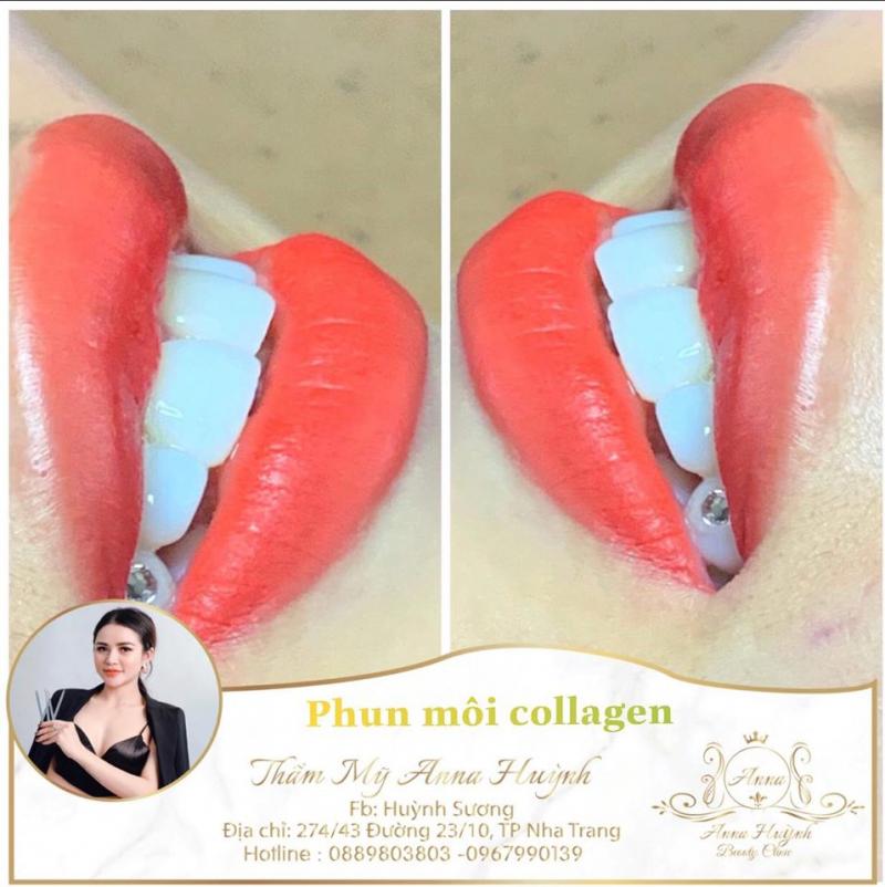 Thẩm Mỹ Anna Huỳnh