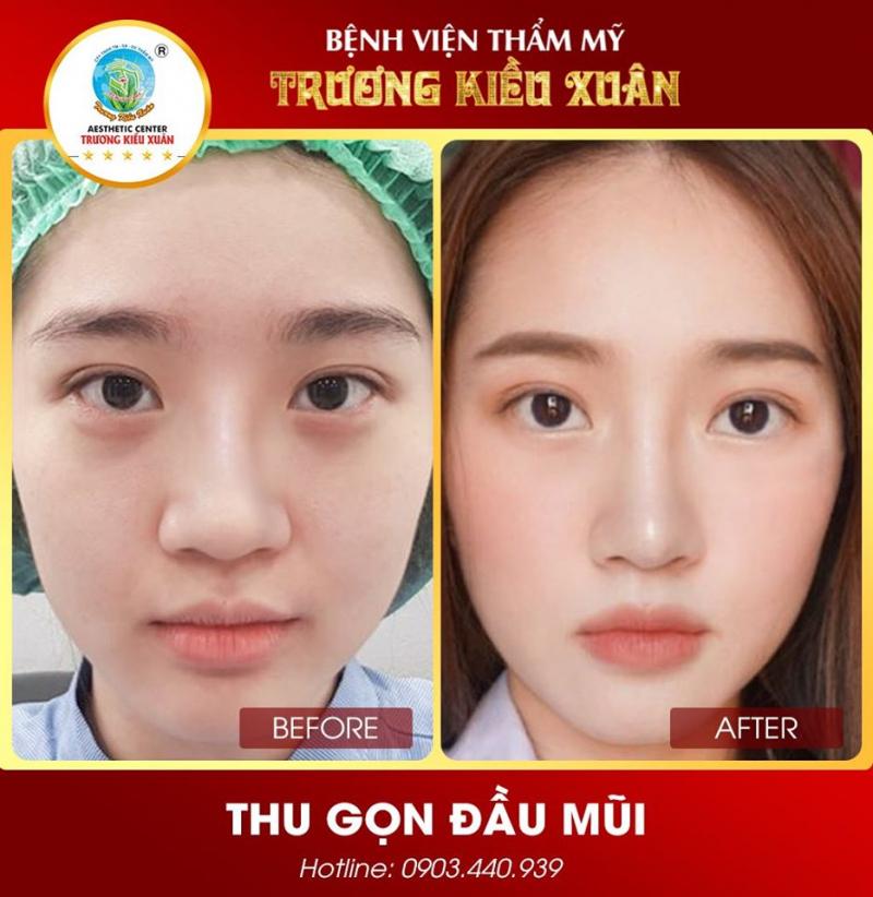 Bệnh Viện Thẩm Mỹ Trương Kiều Xuân