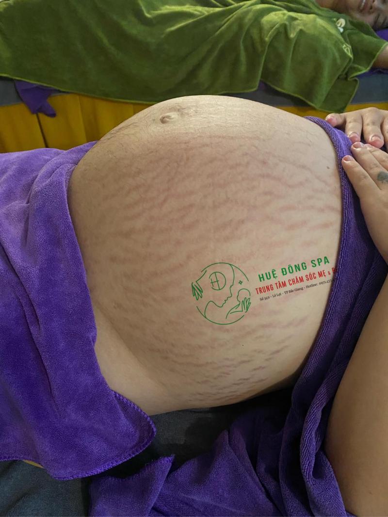 Huệ Đông Spa