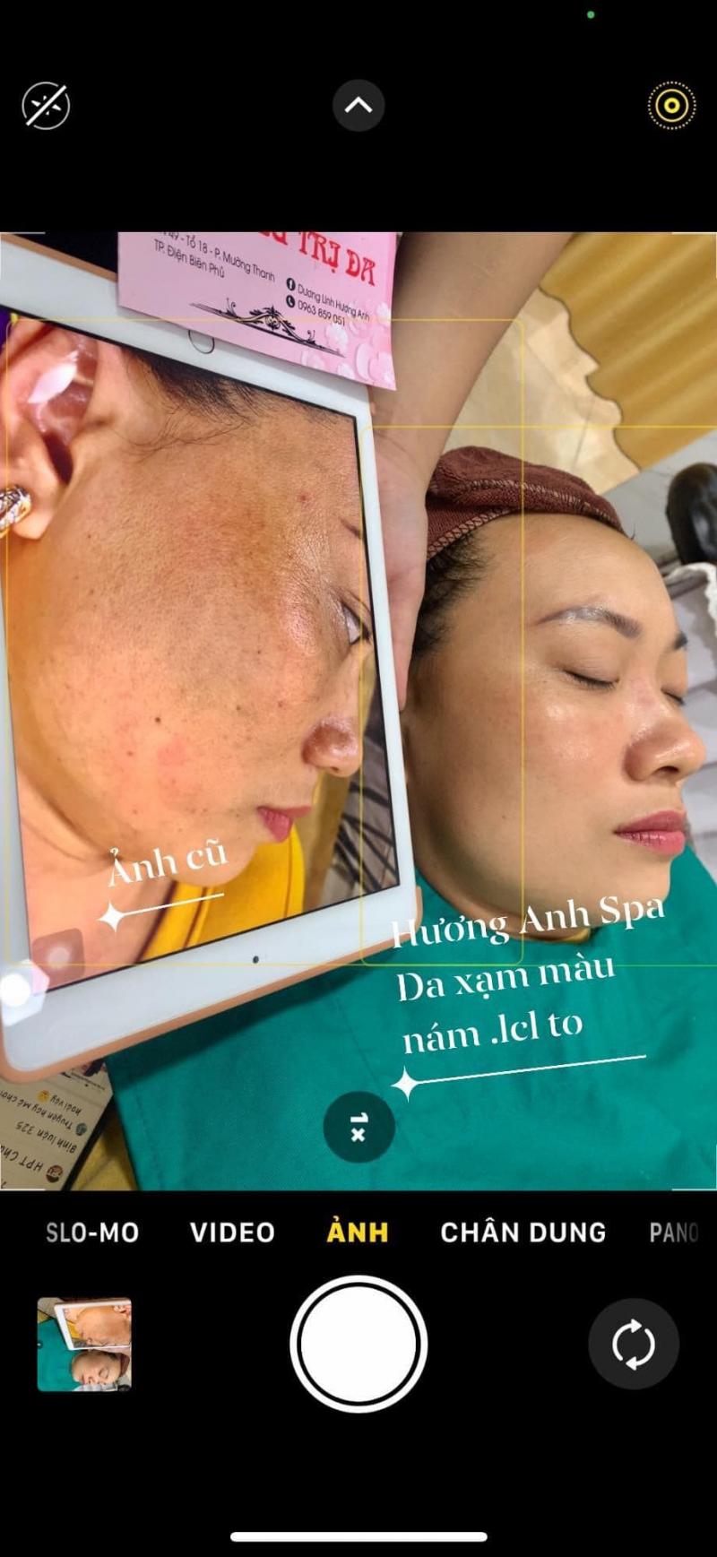Hương Anh Spa - Beauty center